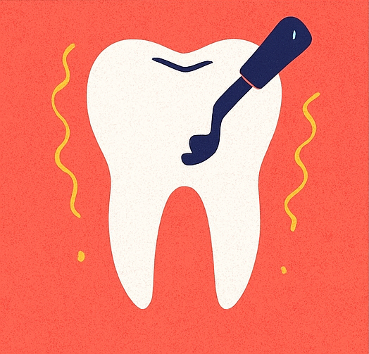 Лечение кариеса