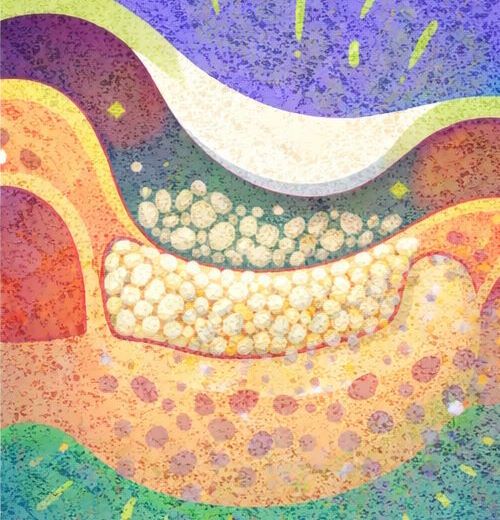 Наращивание костной ткани