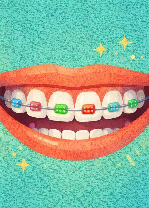 Исправление прикуса у детей